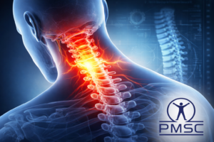 علاج آلام الرقبة باستخدام العلاج الطبيعي في عمان