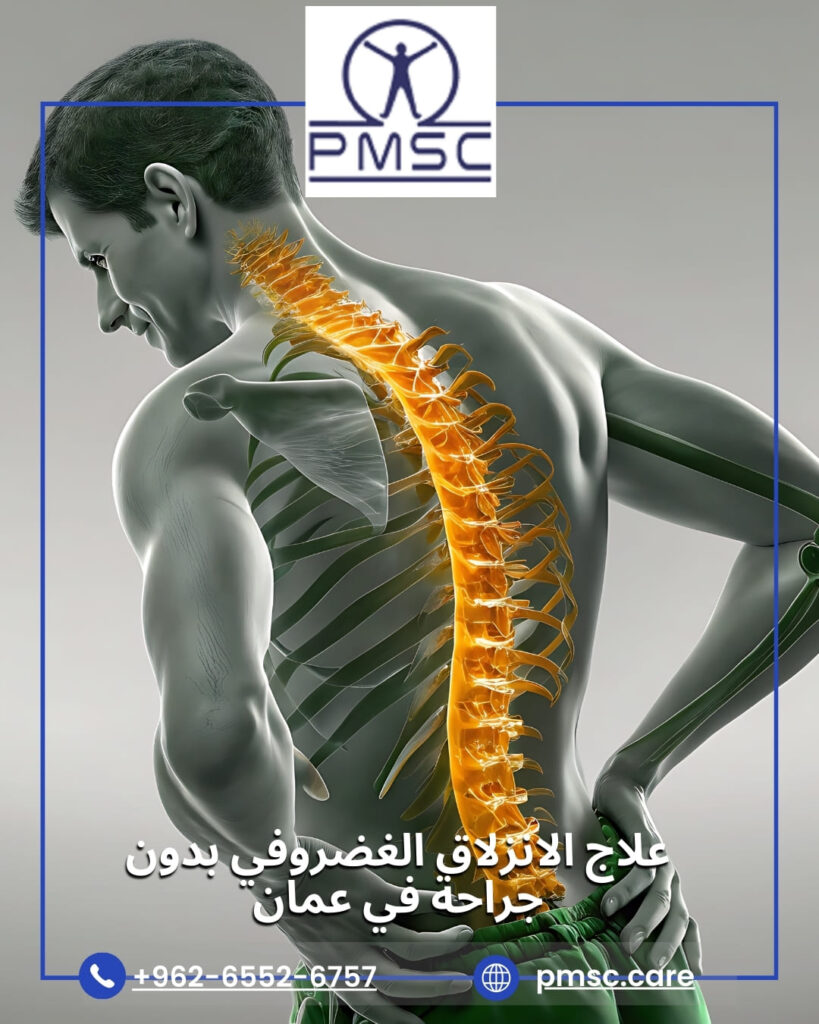 علاج الانزلاق الغضروفي بدون جراحة