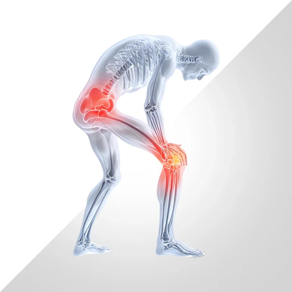 أعراض التهاب المفاصل